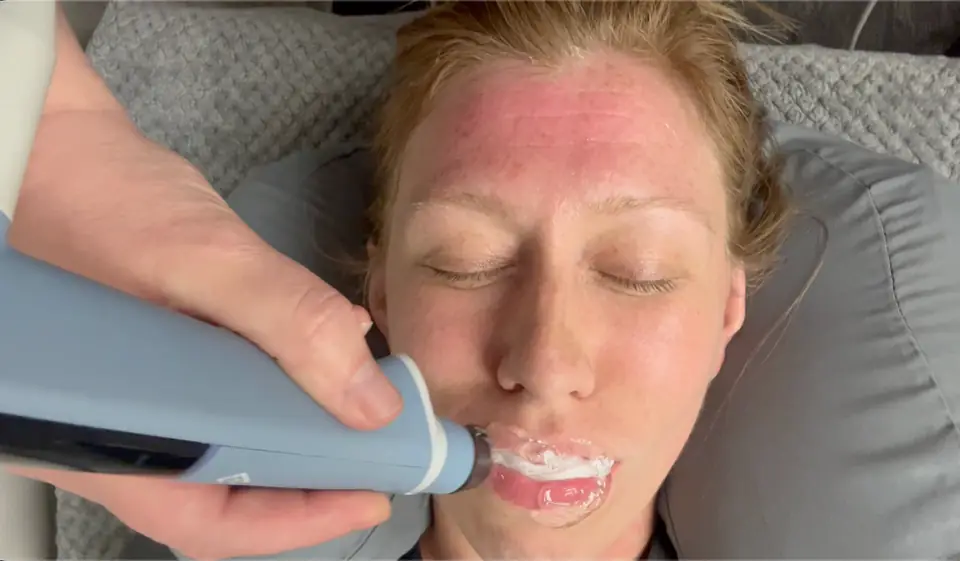 EXION Face & Body skin rejuvenation treatment